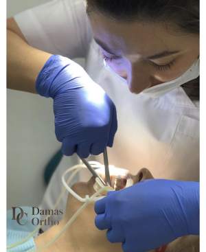 В процессе ортодонтического лечения: коррекция