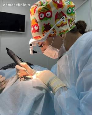Трансплантация волос в процессе. Доктор Альбина Дахировна Тебуева