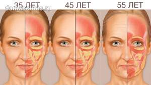 Возрастные изменения тканей лица – показания к классическому фейслифтингу