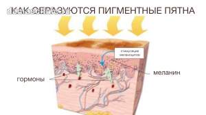 Процесс образования пигментных пятен на коже